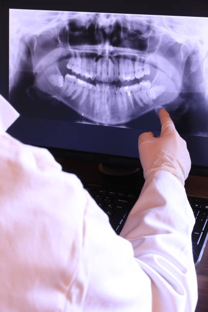 Best Emergency Tooth Extraction in Lewiston, ME